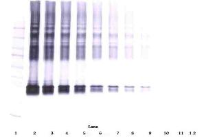 Western Blotting (WB) image for anti-serpin Peptidase Inhibitor, Clade B (Ovalbumin), Member 5 (SERPINB5) antibody (ABIN487960)