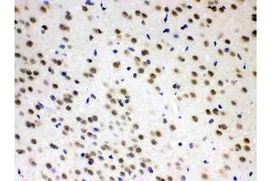 AZIN2 was detected in paraffin-embedded sections of rat brain tissues using rabbit anti- AZIN2 Antigen Affinity purified polyclonal antibody (Catalog # ) at 1 ? (ADC antibody  (AA 111-301))