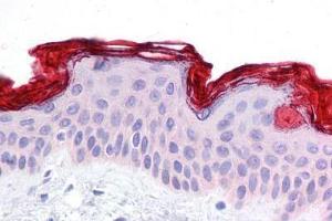 Human Skin: Formalin-Fixed, Paraffin-Embedded (FFPE) (DBT antibody  (AA 35-84))