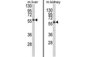 (LEFT) Western blot analysis of PRODH Antibody (RB21343) in mouse liver tissue lysates (35ug/lane). (PRODH antibody  (Middle Region))