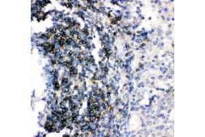 Immunohistochemistry (IHC) image for anti-CD79b Molecule, Immunoglobulin-Associated beta (CD79B) (AA 29-229) antibody (ABIN3043398)