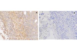 Immunohistochemistry (IHC) image for anti-G Protein-Coupled Receptor, Family C, Group 5, Member D (GPRC5D) (AA 1-27) antibody (ABIN6964058)