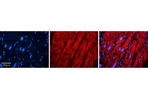 Rabbit Anti-EPRS Antibody   Formalin Fixed Paraffin Embedded Tissue: Human heart Tissue Observed Staining: Cytoplasmic Primary Antibody Concentration: N/A Other Working Concentrations: 1:600 Secondary Antibody: Donkey anti-Rabbit-Cy3 Secondary Antibody Concentration: 1:200 Magnification: 20X Exposure Time: 0. (EPRS antibody  (Middle Region))