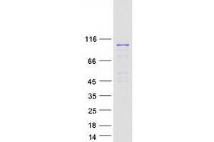 Validation with Western Blot (RASEF Protein (Myc-DYKDDDDK Tag))