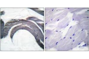 Immunohistochemistry analysis of paraffin-embedded human skeletal muscle, using Glycogen Synthase (Phospho-Ser645) Antibody. (Glycogen Synthase antibody  (pSer645))