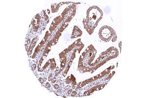 Duodenum with strong cytoplasmic caspase 3 positivity of epithelial cells (Recombinant Caspase 3 antibody  (Center))