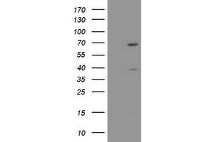 Image no. 1 for anti-tRNA Methyltransferase 2 Homolog A (TRMT2A) antibody (ABIN1501522) (TRMT2A antibody)