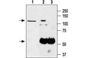 Immunoprecipitation of PC-12 lysates: - 1. (TRPA1 antibody  (1st Extracellular Loop))