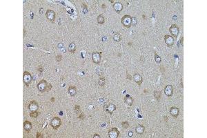 Immunohistochemistry of paraffin-embedded Rat brain using ITGB8 Polyclonal Antibody at dilution of 1:100 (40x lens). (ITGB8 antibody)