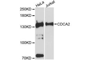 Western blot analysis of extracts of various cell lines, using CDCA2 antibody (ABIN5996800) at 1:3000 dilution.