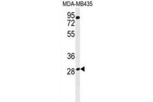 Western Blotting (WB) image for anti-Ras-Related GTP Binding D (RRAGD) antibody (ABIN3002183) (RRAGD antibody)