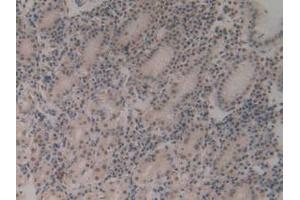 IHC-P analysis of Human Stomach Tissue, with DAB staining. (CIRBP antibody  (AA 1-172))