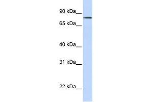 WB Suggested Anti-LST-3TM12 Antibody Titration:  0. (LST-3TM12 antibody  (Middle Region))