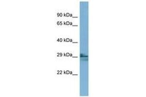 Image no. 1 for anti-Lens Intrinsic Membrane Protein 2, 19kDa (LIM2) (AA 35-84) antibody (ABIN6741876) (LIM2 antibody  (AA 35-84))