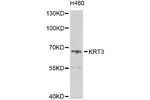 Western blot analysis of extracts of H460 cells, using KRT3 Antibody (ABIN6003816) at 1/1000 dilution.
