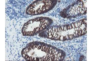 Image no. 10 for anti-FXYD Domain Containing Ion Transport Regulator 3 (FXYD3) antibody (ABIN1498341)