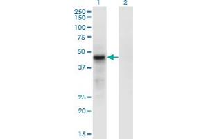 Western Blot analysis of CDC42EP4 expression in transfected 293T cell line by CDC42EP4 monoclonal antibody (M05), clone 3G10. (CDC42EP4 antibody  (AA 163-225))