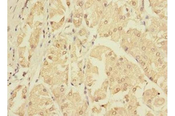 ZNF624 antibody  (AA 127-327)
