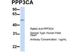 Host:  Rabbit  Target Name:  PPP3CA  Sample Type:  Human Fetal Heart  Antibody Dilution:  1. (PPP3CA antibody  (Middle Region))