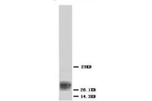 Western blot analysis of Hela cell lysis using BAX antibody