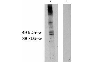 Western blot analysis using LAG1 longevity assurance homolog 2 . (Ceramide Synthase 2 antibody)