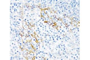 Immunohistochemistry of paraffin-embedded Human tonsil using PLA2G4C Polyclonal Antibody at dilution of 1:100 (40x lens). (PLA2G4C antibody)