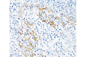 Immunohistochemistry of paraffin-embedded Human tonsil using PLA2G4C Polyclonal Antibody at dilution of 1:100 (40x lens).