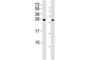 Western blot testing of RHOXF1 antibody at 1:2000 (RHOXF1 antibody  (AA 85-120))