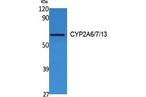 Western Blotting (WB) image for anti-CYP2A6/7/13 (Internal Region) antibody (ABIN3180978) (CYP2A6/7/13 (Internal Region) antibody)