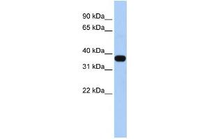 Western Blotting (WB) image for anti-Mitochondrial E3 Ubiquitin Protein Ligase 1 (MUL1) antibody (ABIN2458733)