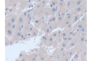 Detection of SNAP23 in Human Liver Tissue using Polyclonal Antibody to Synaptosomal Associated Protein 23 kDa (SNAP23) (SNAP23 antibody  (AA 1-211))
