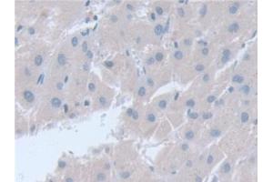 Detection of SNAP23 in Human Liver Tissue using Polyclonal Antibody to Synaptosomal Associated Protein 23 kDa (SNAP23)