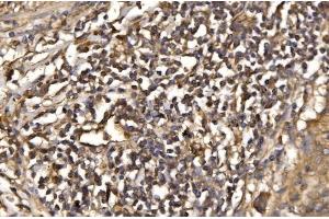 IHC analysis of ASK1/MAP3K5 using anti-ASK1/MAP3K5 antibody (ABIN7600304).