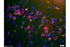 Formalin-fixed and paraffin embedded rat brain carcinoma labeled with Rabbit Anti-ApoA4 Polyclonal Antibody, Unconjugated (ABIN749153) at 1:200 followed by secondary antibody was Goat Anti-Rabbit IgG, Cy3 conjugated used at 1:200 dilution for 40 minutes at 37°C. (APOA4 antibody  (AA 21-120))