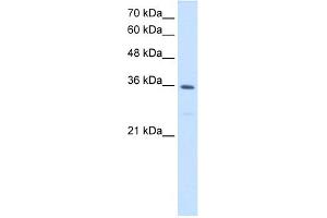WB Suggested Anti-MTHFD2 Antibody Titration:  1. (MTHFD2 antibody  (N-Term))