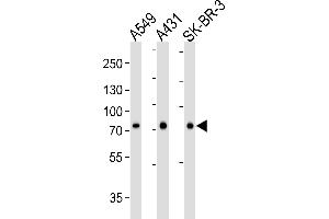 Western blot analysis of lysates from A549, A431, SK-BR-3 cell line (from left to right), using CN2 Antibody (ABIN6244177 and ABIN6577076). (Calpain 2 antibody  (AA 1-400))