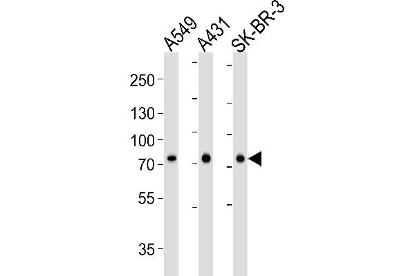 Calpain 2 antibody  (AA 1-400)
