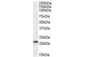 Image no. 1 for anti-Ubiquitin-Conjugating Enzyme E2T (Ube2t) (C-Term) antibody (ABIN374292) (Ube2t antibody  (C-Term))