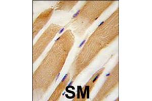 Formalin-fixed and paraffin-embedded human skeletal muscle tissue reacted with ACTB/ACTC antibody , which was peroxidase-conjugated to the secondary antibody, followed by DAB staining. (Actin antibody  (AA 189-218))