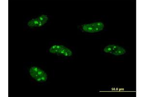 Immunofluorescence of monoclonal antibody to PWP1 on HeLa cell.