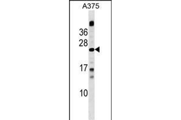 MBD3L1 Antikörper  (C-Term)