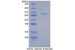 SDS-PAGE (SDS) image for Heparan Sulfate Proteoglycan 2 (HSPG2) (AA 4149-4391) protein (His tag) (ABIN1099147)