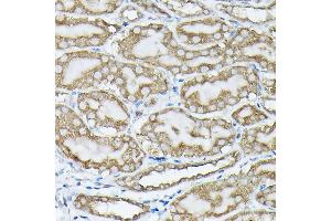 Immunohistochemistry of paraffin-embedded mouse kidney using Phospho-KRAS-S89 Rabbit pAb (ABIN7267530) at dilution of 1:100 (40x lens). (K-RAS antibody  (pSer89))