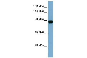 CASD1 antibody used at 1 ug/ml to detect target protein. (CASD1 antibody  (N-Term))