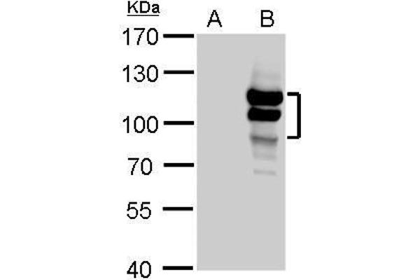L3MBTL1 antibody  (Center)