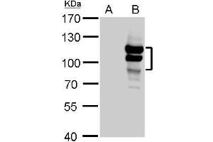 WB Image L3MBTL antibody detects L3MBTL protein by Western blot analysis. (L3MBTL1 antibody  (Center))