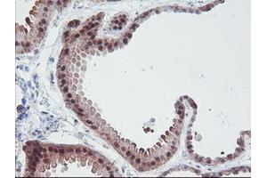 Immunohistochemical staining of paraffin-embedded Human breast tissue using anti-IRF6 mouse monoclonal antibody. (IRF6 antibody)