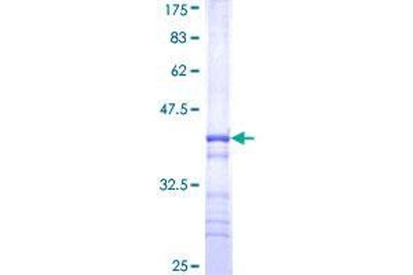 WSB2 Protein (AA 1-105) (GST tag)