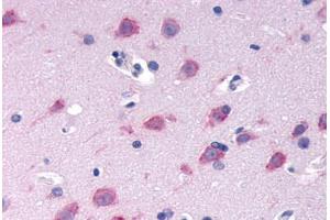 Anti-GPRC6A antibody  ABIN1048920 IHC staining of human brain, neurons and glia. (GPRC6A antibody  (N-Term))
