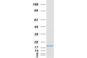 Validation with Western Blot (CDO1 Protein (Myc-DYKDDDDK Tag))